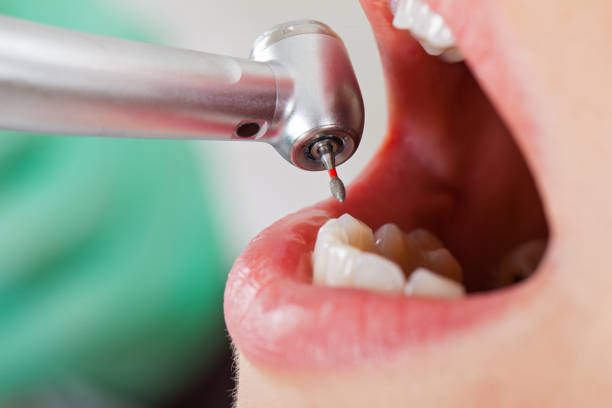 Best Weekend Emergency Dental Services in Chelsea, MI
